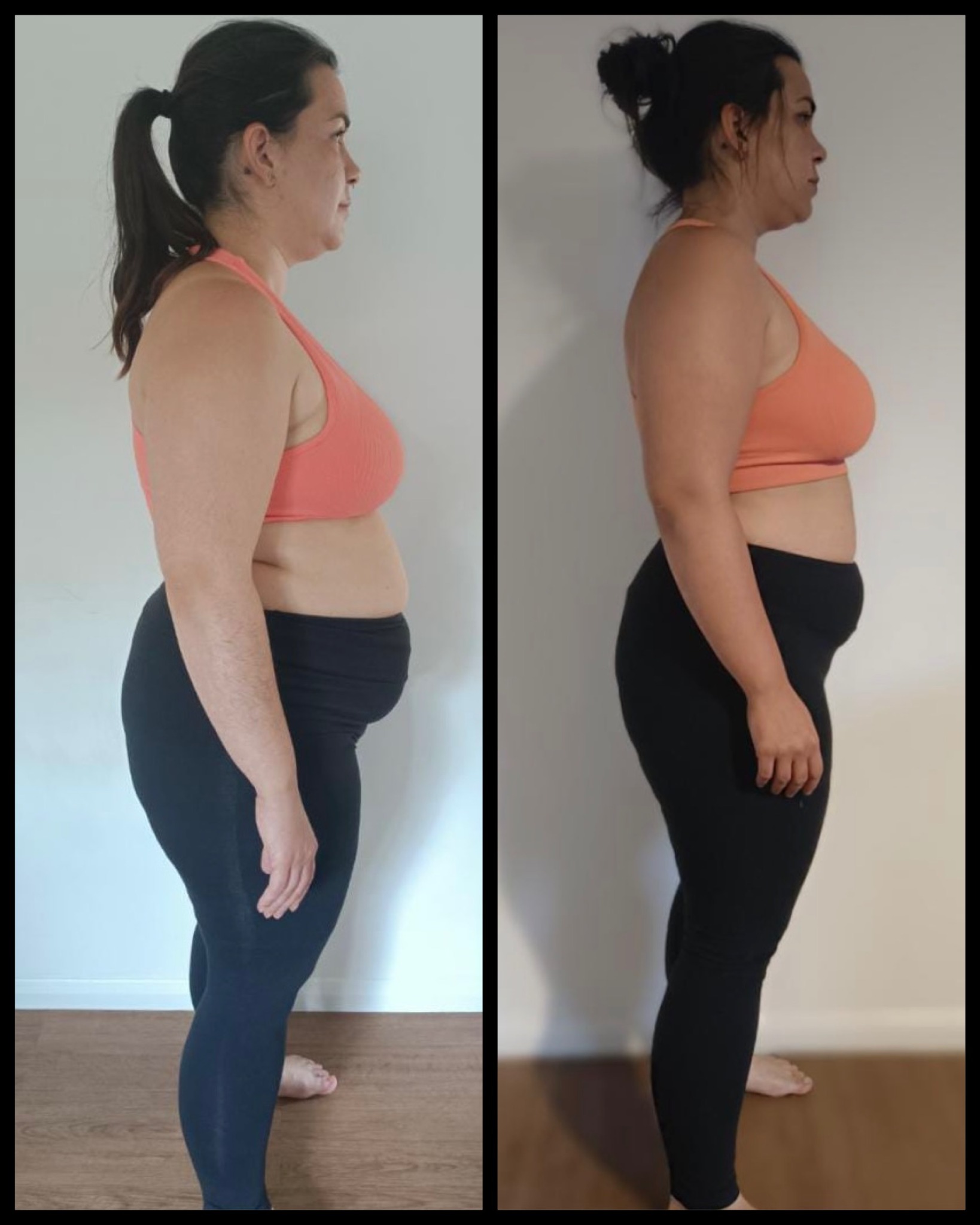 RBT member side view transformation before and after