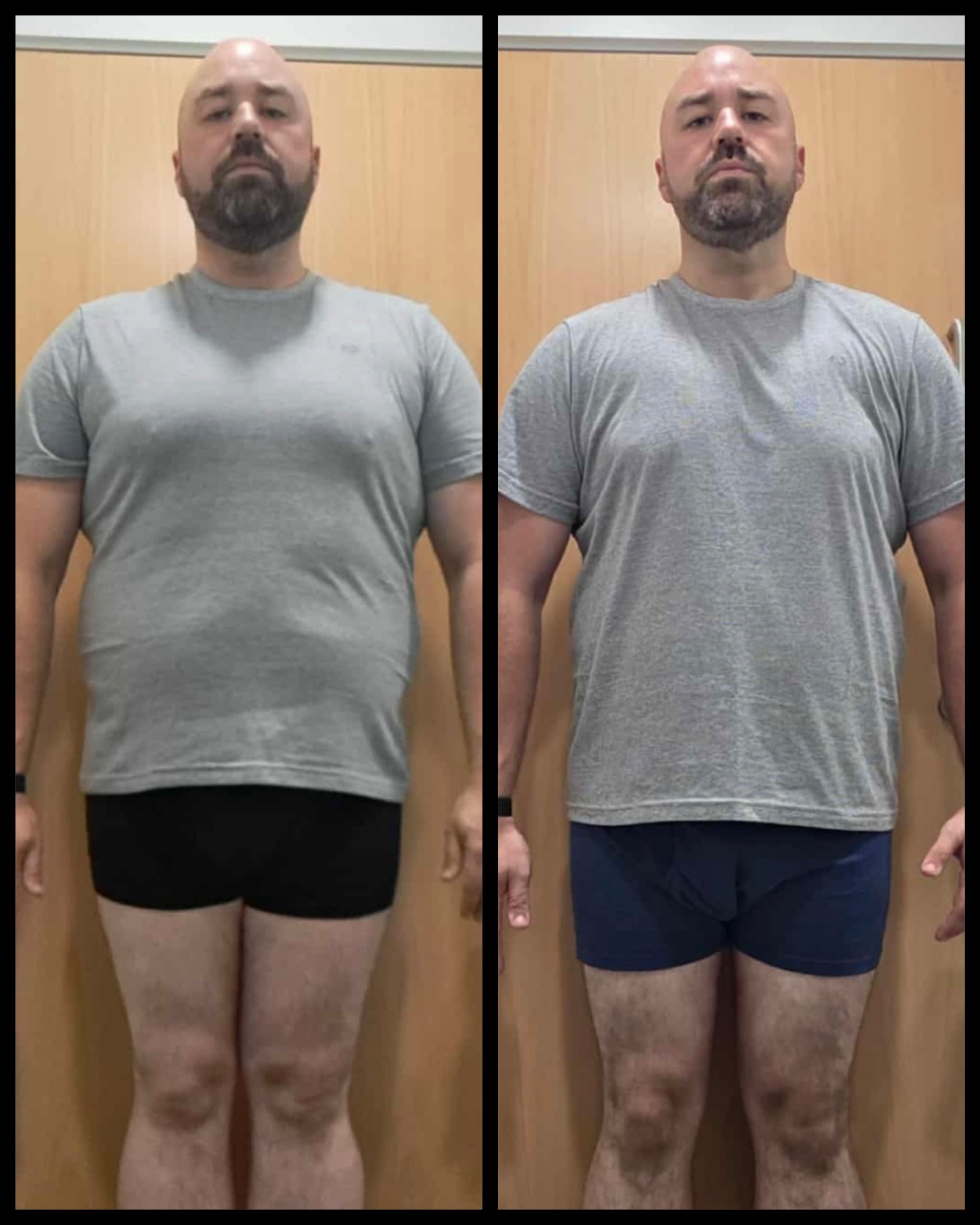 RBT member back view transformation before and after